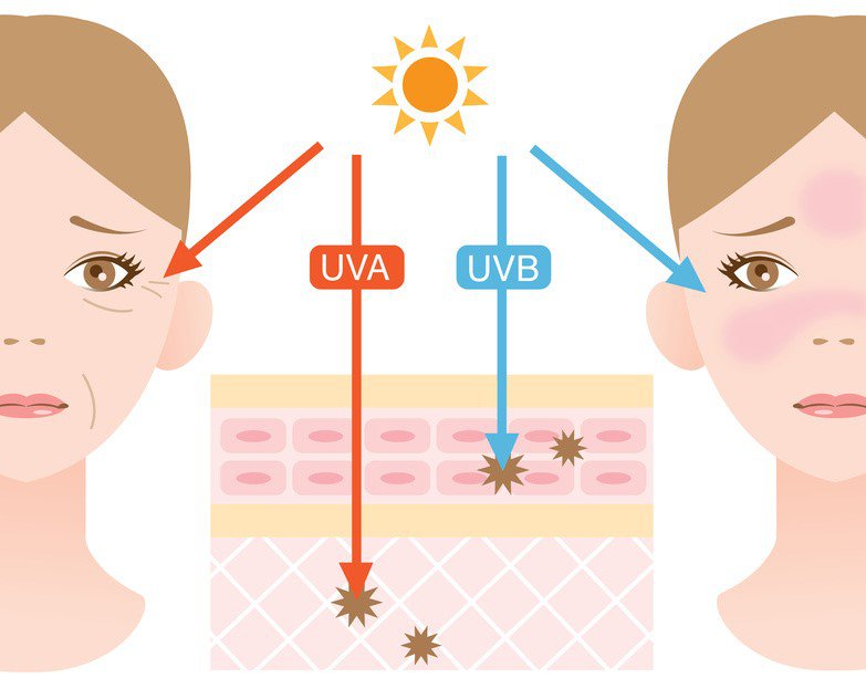 Bức xạ tia UVA và UVB - Bức xạ tia cực tím B (UVB, bước sóng 290 đến 320 nm) có liên quan chặt chẽ với sự phát triển của khối u ác tính ở da